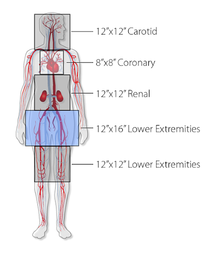 Ангиограф Canon (Toshiba) INFINIX СF-i/SP (кардиологический) 4 29.png