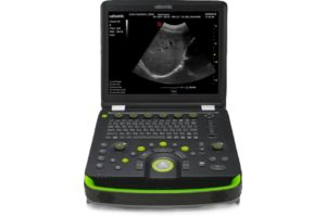 Аппарат ультразвуковой диагностический Clover 60
