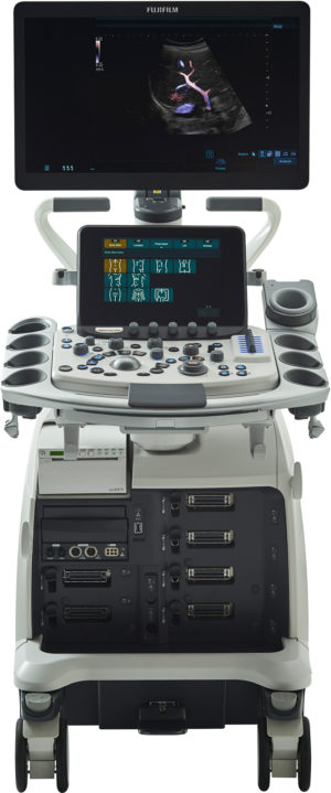 УЗИ аппарат Hitachi Aloka (Fujifilm) Arietta 850