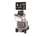 УЗИ аппарат Philips EPIQ Elite