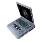 УЗИ аппарат Siui Apogee 1100 Neo — изображение 2