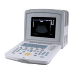 УЗИ сканер Med-Mos CMS600B3 — изображение 2