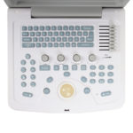 УЗИ сканер Med-Mos CMS600B3 — изображение 21